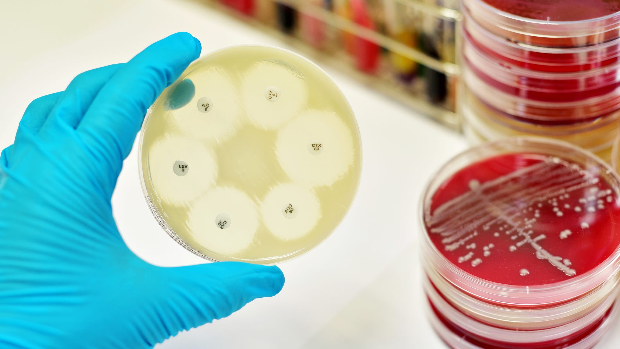Why humans are losing the race against superbugs