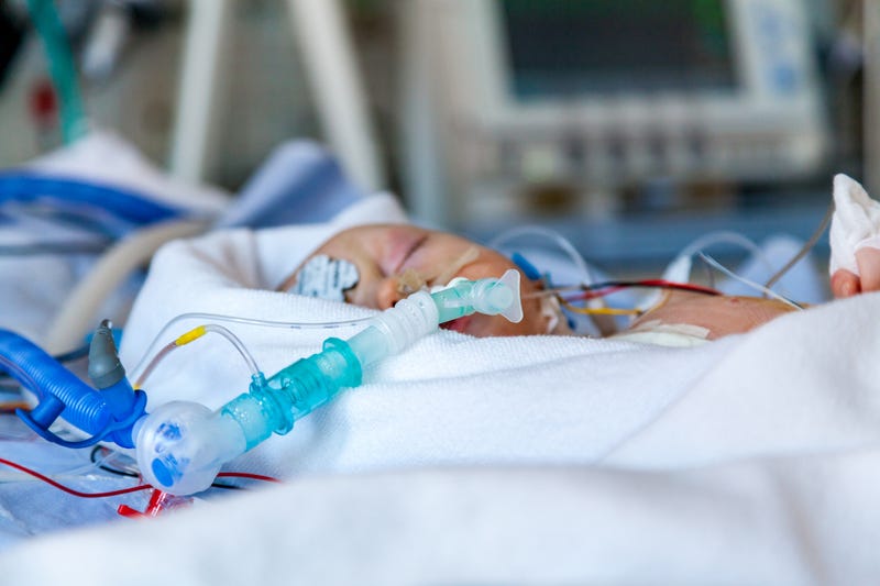 Infant in NICU care