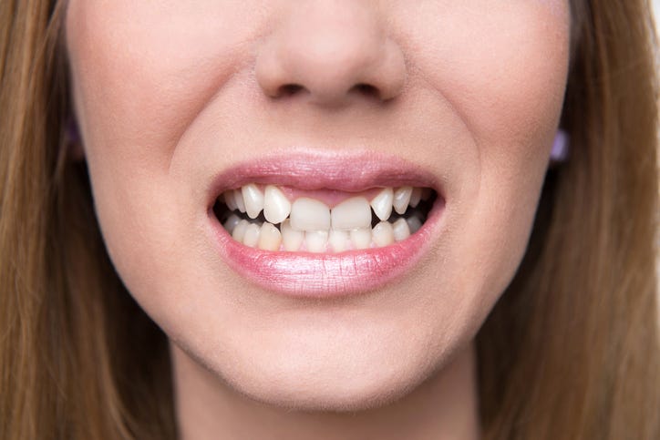 Teeth