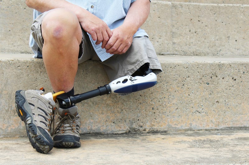 Prosthetic leg