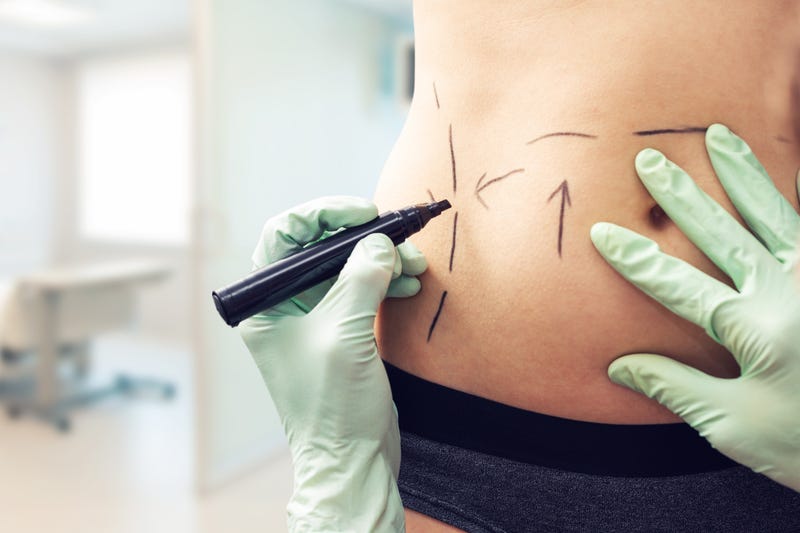 surgery