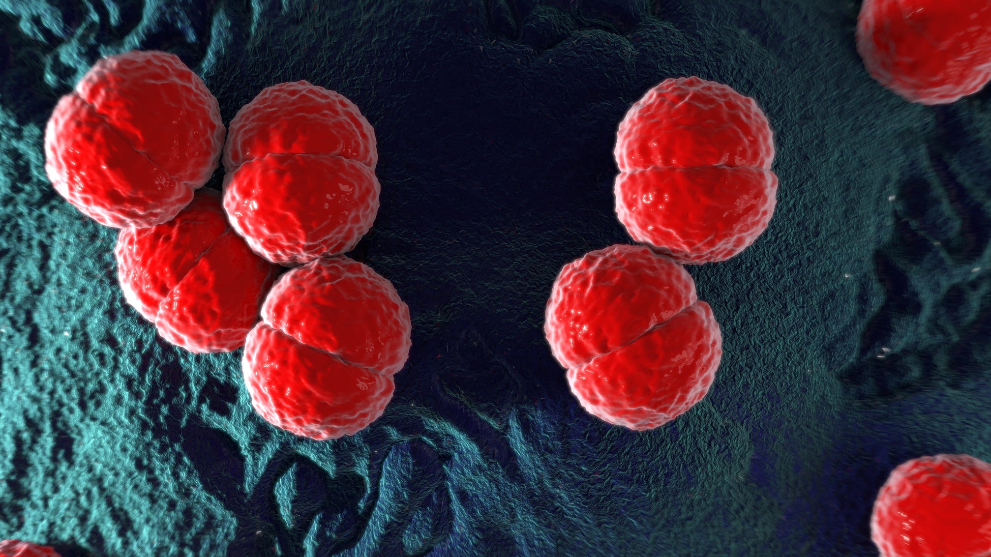 CDC recommends meningitis vaccines amid Florida outbreak