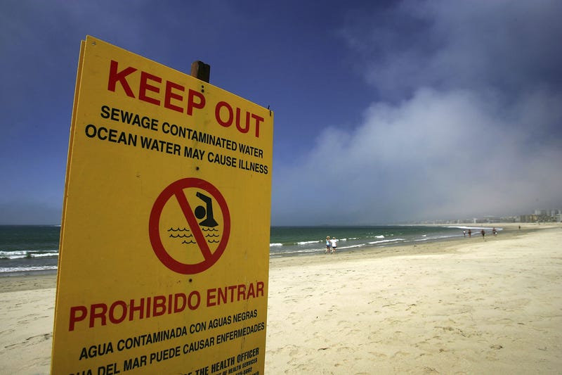 LOS ANGELES - AUGUST 09: Warning signs keep bathers out of the water at the south end of Venice Beach on August 9, 2006 in Los Angeles, California.