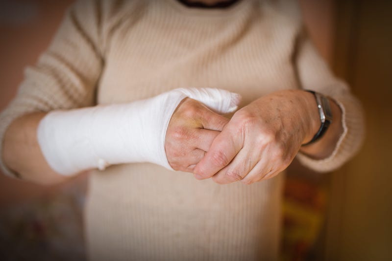Older woman with broken hand