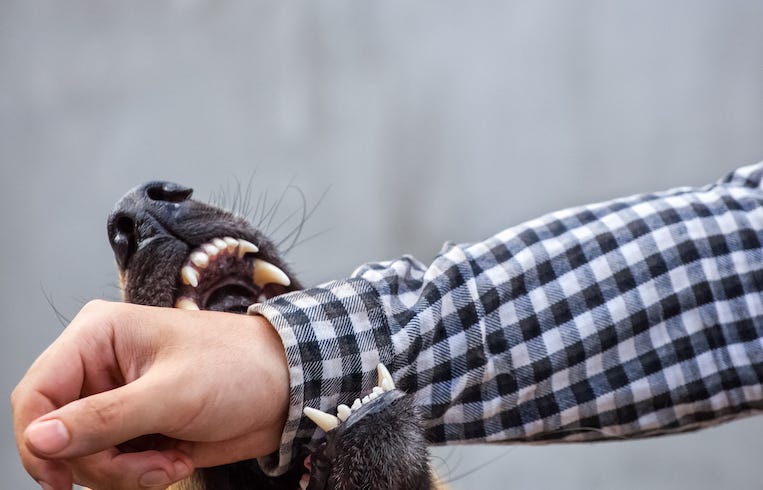 German shepherd bites a man