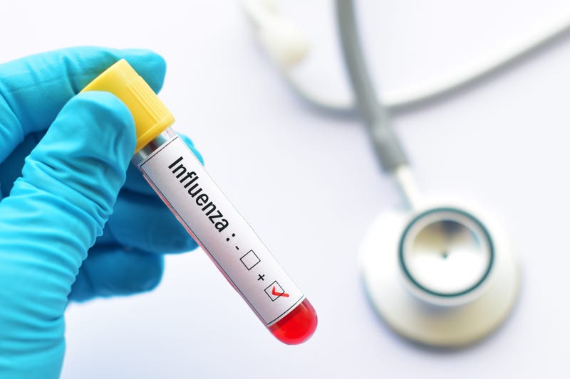 FILE: Blood sample positive with influenza virus