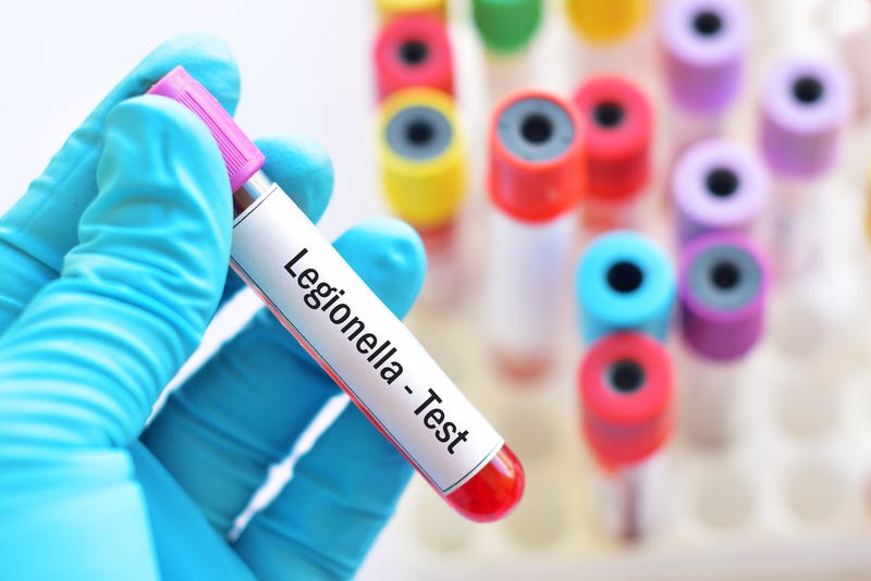A technician holds a vial with blood sample for Legionaires' Disease test