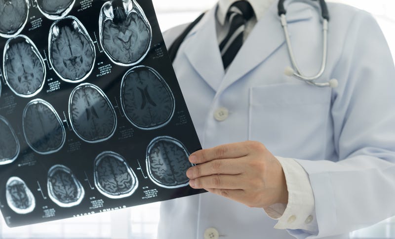 Doctor looking at head scans. 