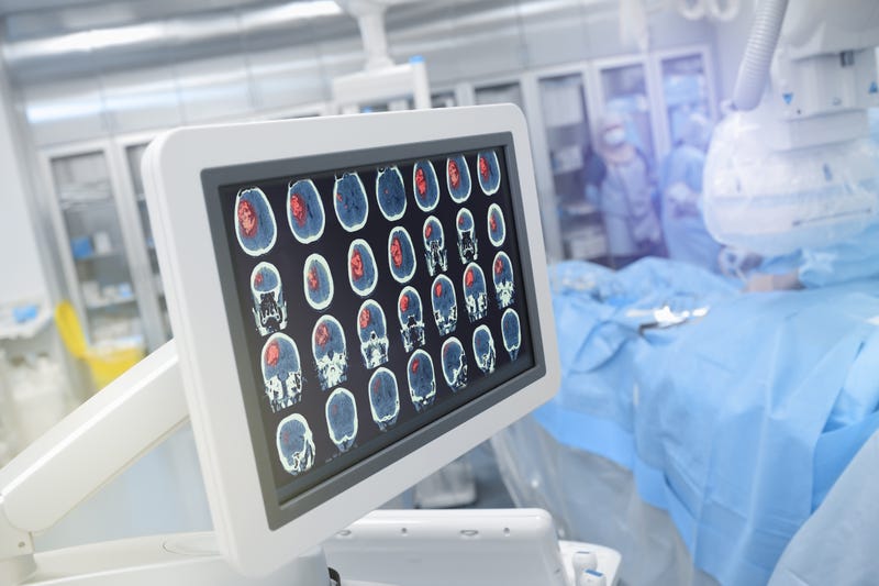 Neurosciences ICU room