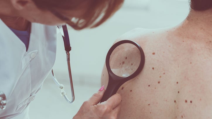 New treatment for advanced melanoma shows promise
