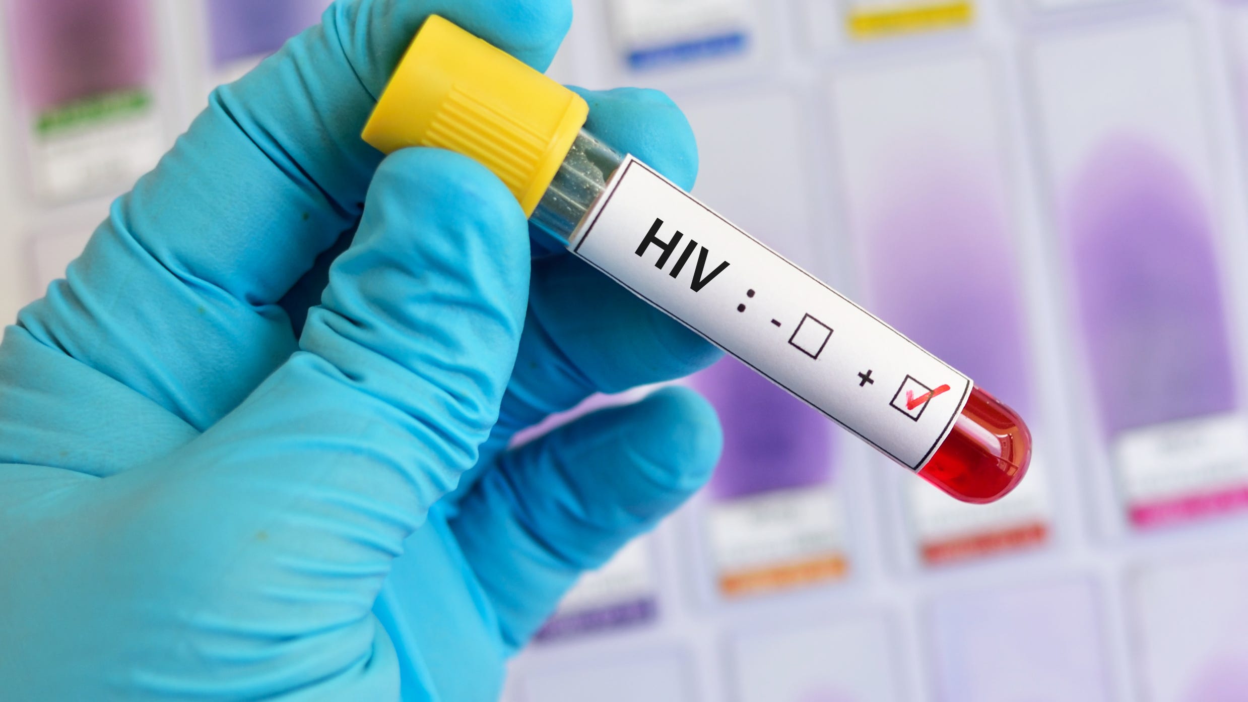 UIC's AIDS training center receives $3 million grant to expand education services