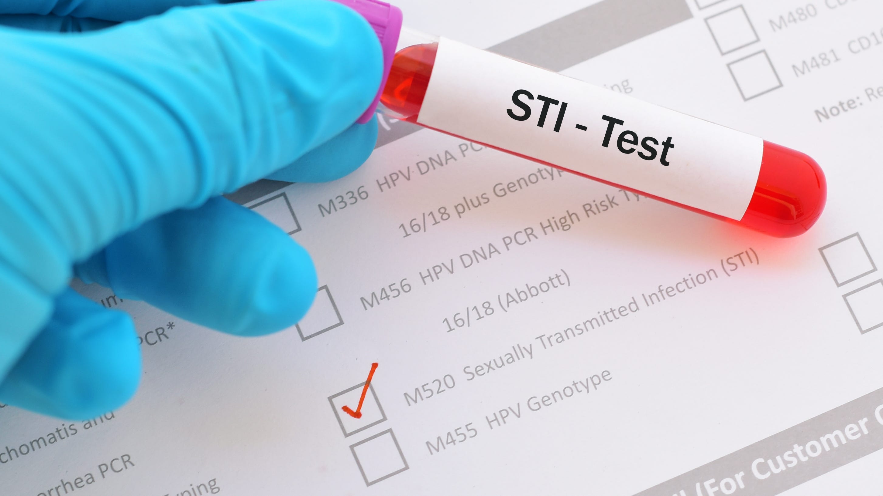 Older drug that’s cheap and easily available found to be effective in preventing three common STIs