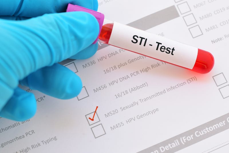 Blood sample for sexually transmitted infection (STI) test.
