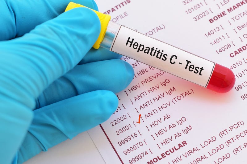 Hep C test