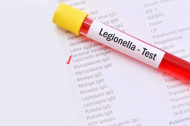 Blood sample with requisition form for Legionella antigen test.