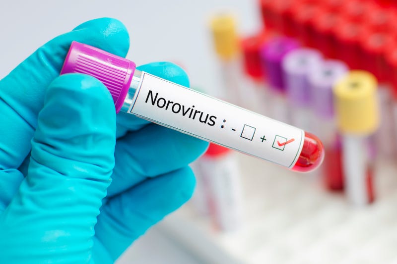Doctors are warning of an early increase in norovirus cases, the highly contagious stomach virus that causes sudden vomiting and diarrhea, as colder weather sends more people indoors.