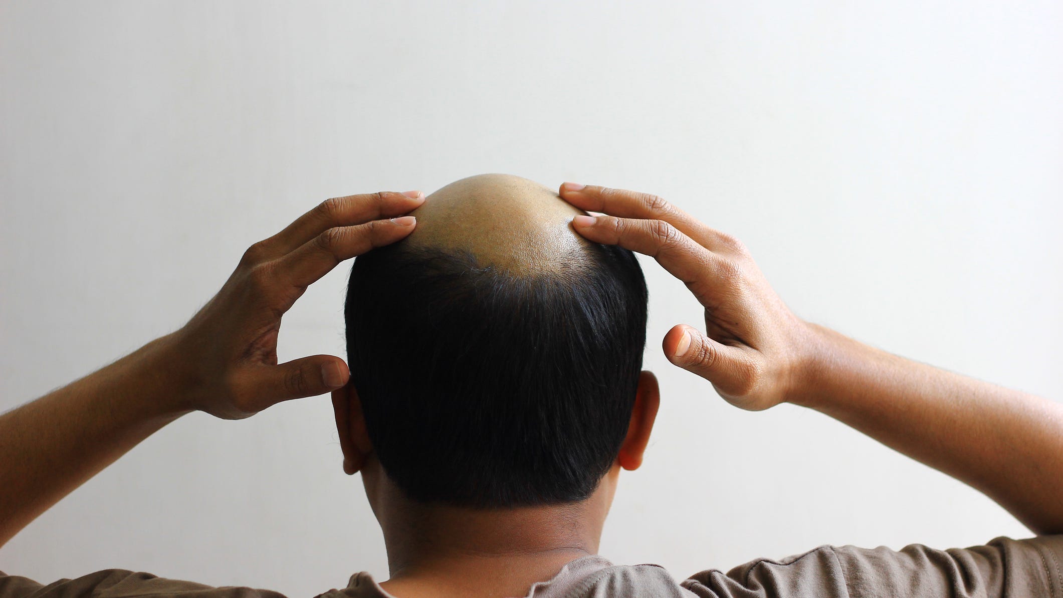 Bald man arrested at hair salon after stylist couldn’t ‘bring his hair back’