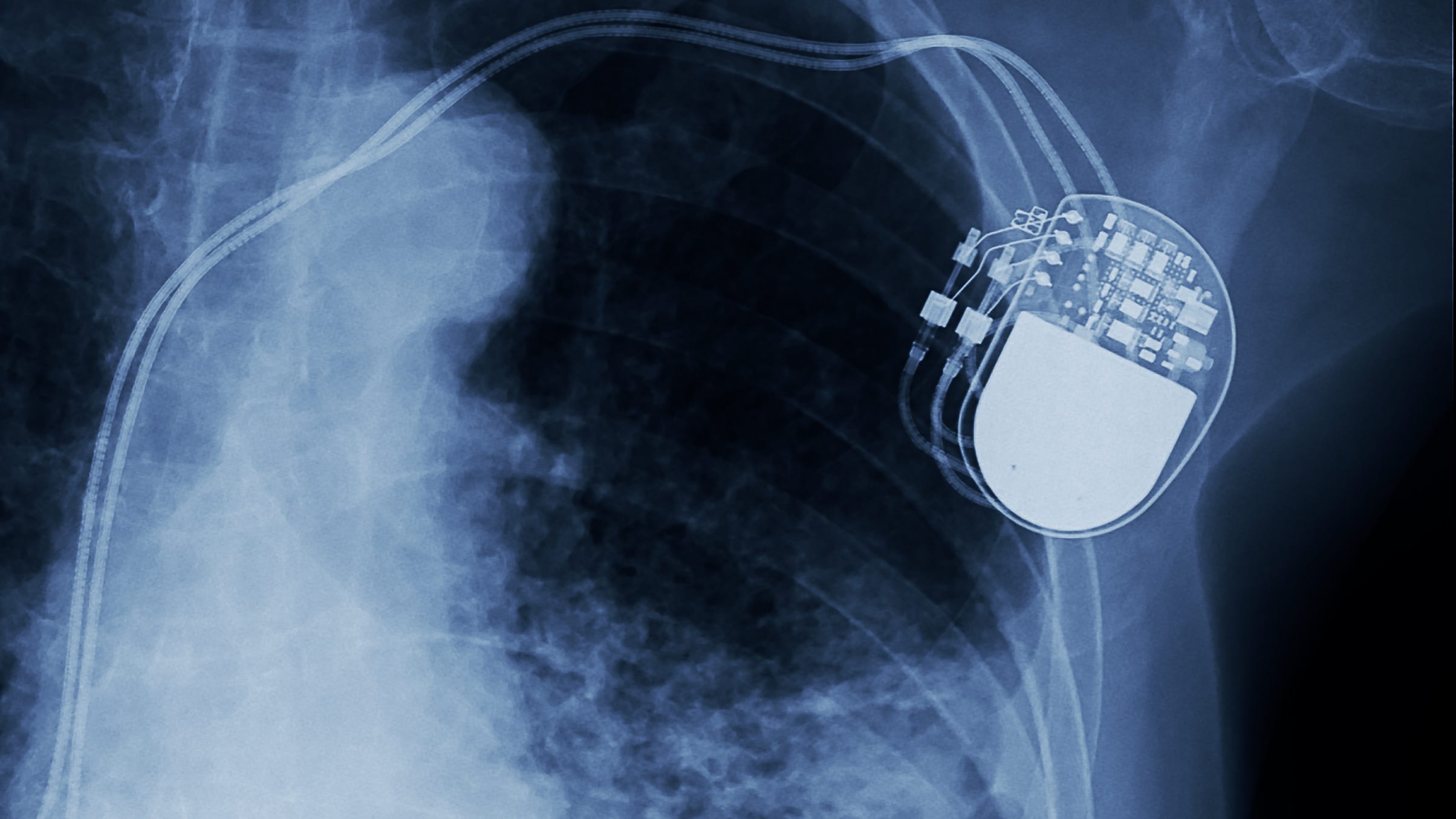 Researchers at Northwestern University develop revolutionary pacemaker