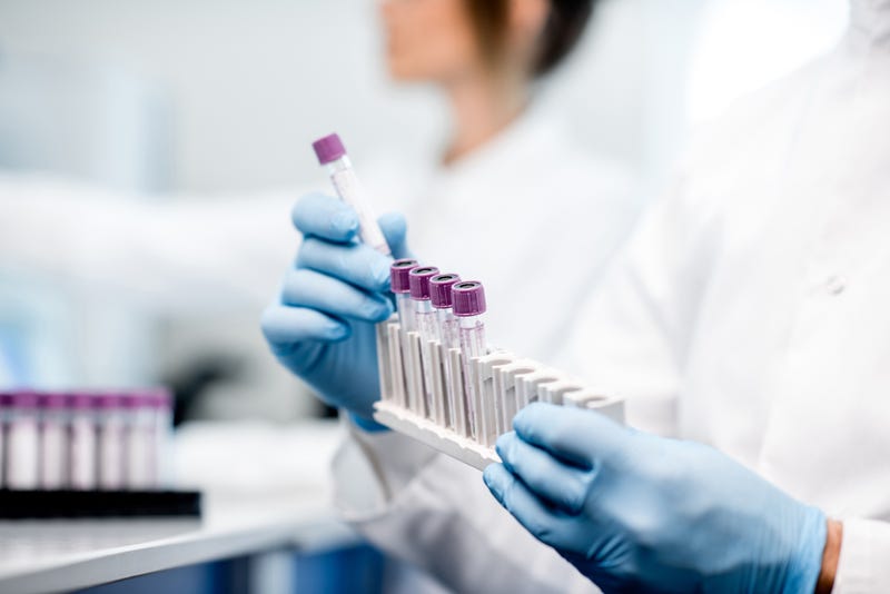 lab tech holding test tubes 