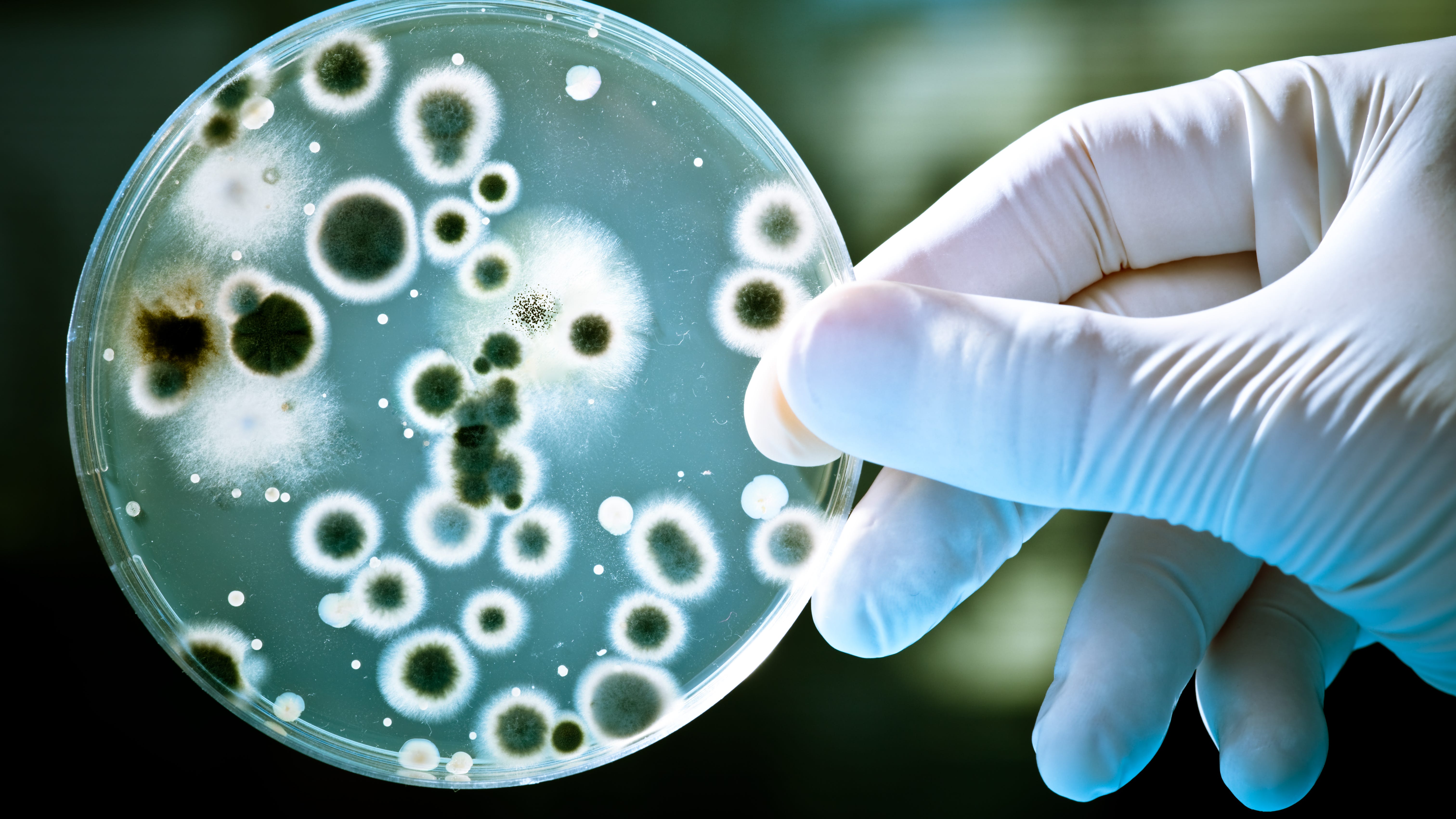 Arlington: Bacteria at city park causes rare, fatal disease in child
