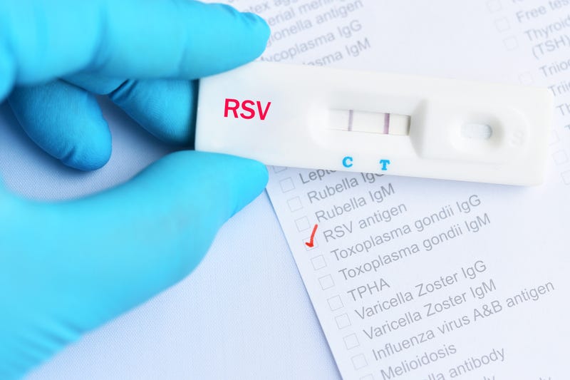 Positive RSV test 