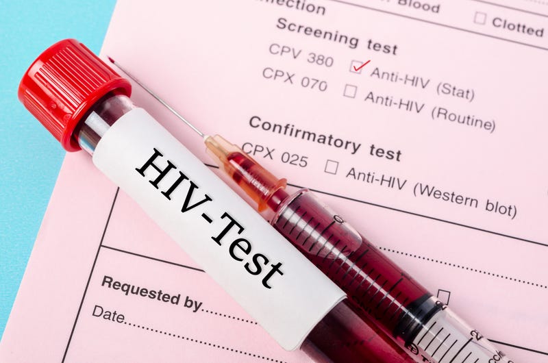 HIV test tube