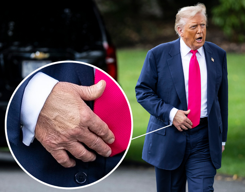 Trump's hand was spotted with makeup on it at the White House on July 15, 2025, prompting questions about why it was applied there