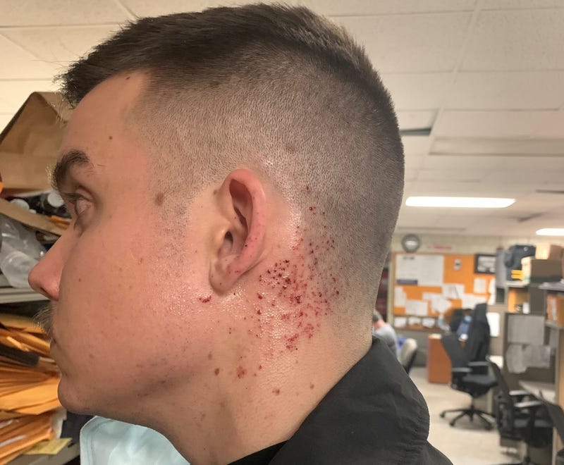 Patrick Keller's injuries from the gunshot incident in Southwest Philadelphia in 2020.