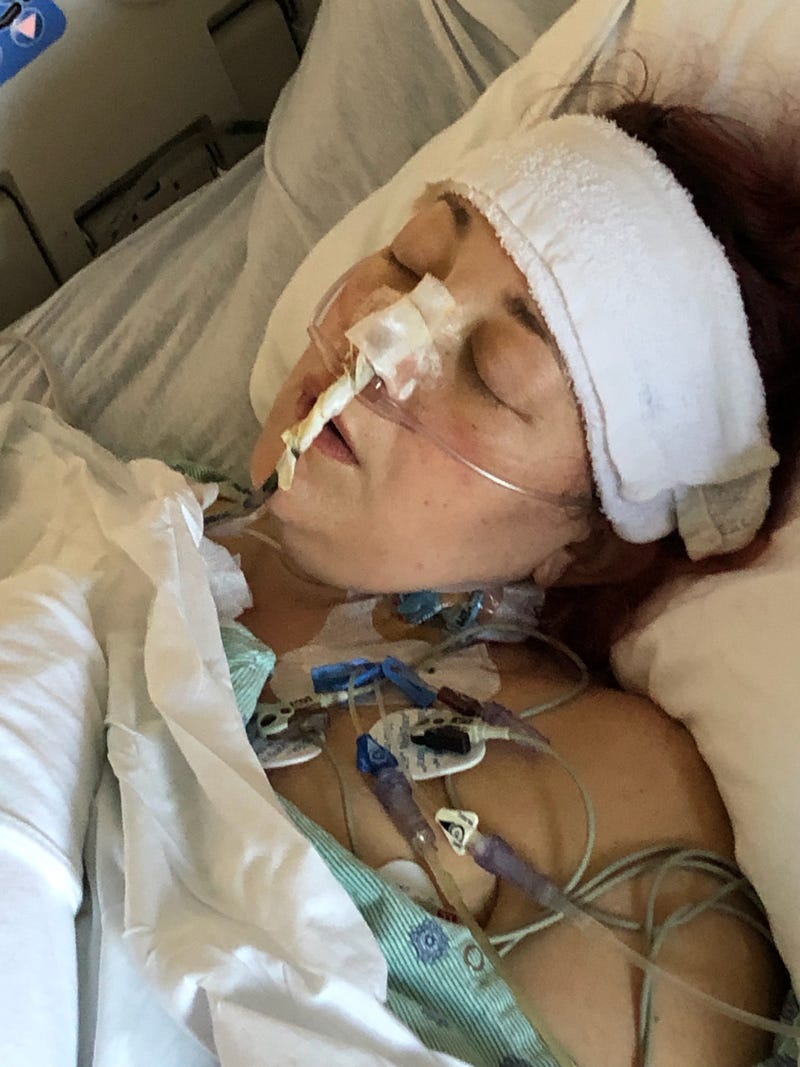 Woman hooked up to EKG and receiving oxygen in nose