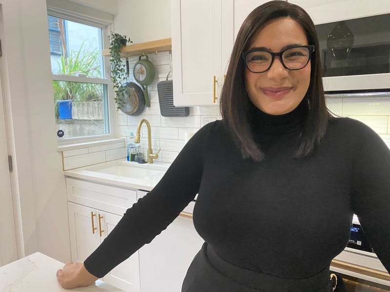Natasha Bidadi Carey, who has experienced hair loss