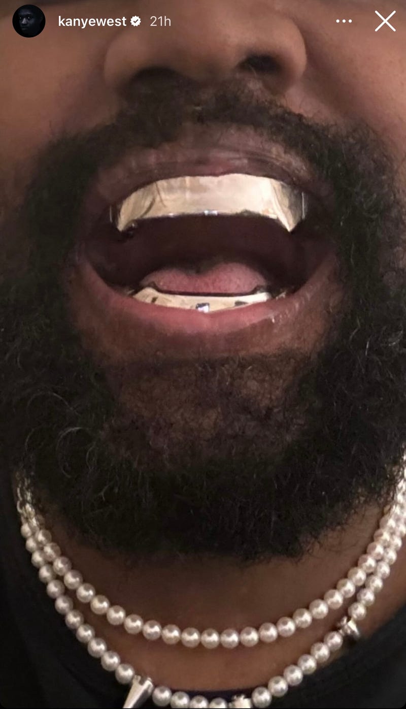 Kanye West IG story