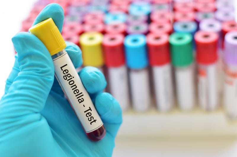 A vial holds blood for a Legionnaires' Disease test