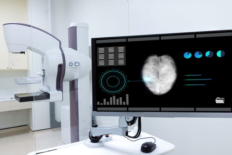 Mammogram, Breast Cancer