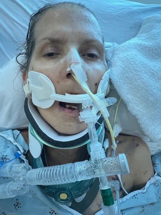 Woman in hospital bed