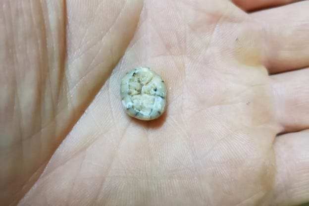 Ancient tooth