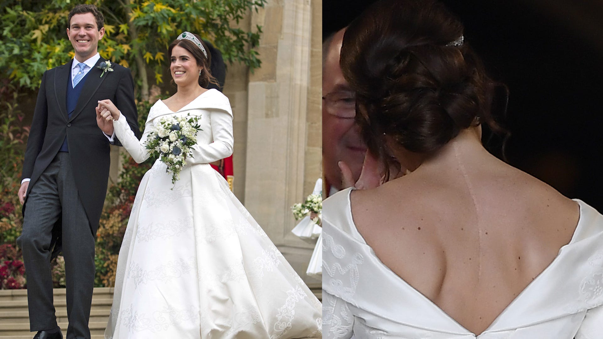 Princess Eugenie Proudly Shows Off Childhood Scar With Wedding Dress