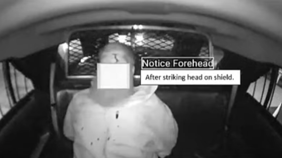 Suspect violently bashed his own head ‘more than 100 times' while in custody after fighting Illinois cops