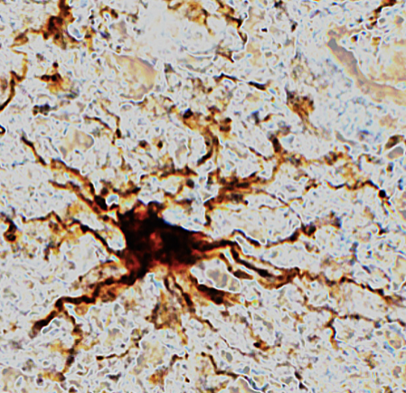 brain