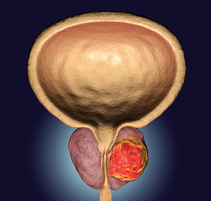 prostate