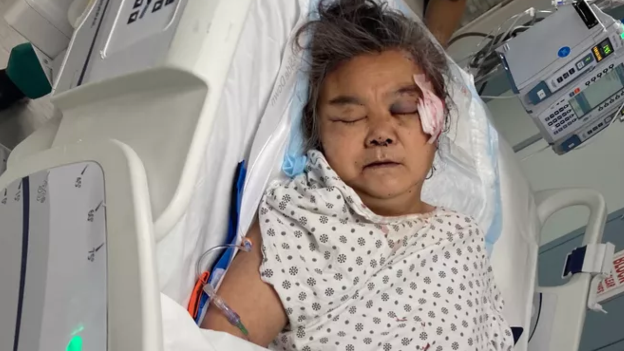 GoFundMe launched after Queens woman, 61, was beaten with rock raises over $40K