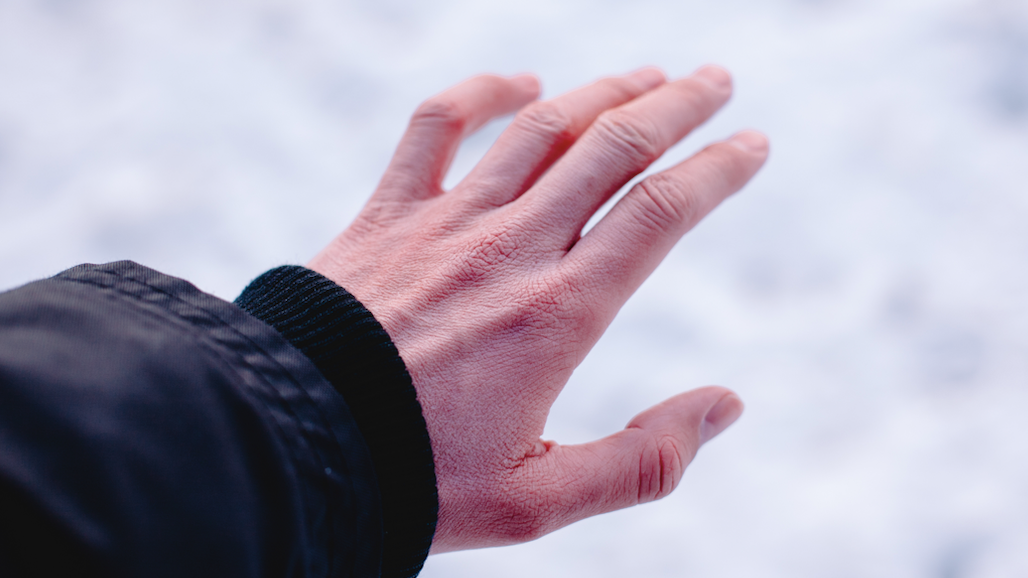 Physician: Don't mess around with frostbite