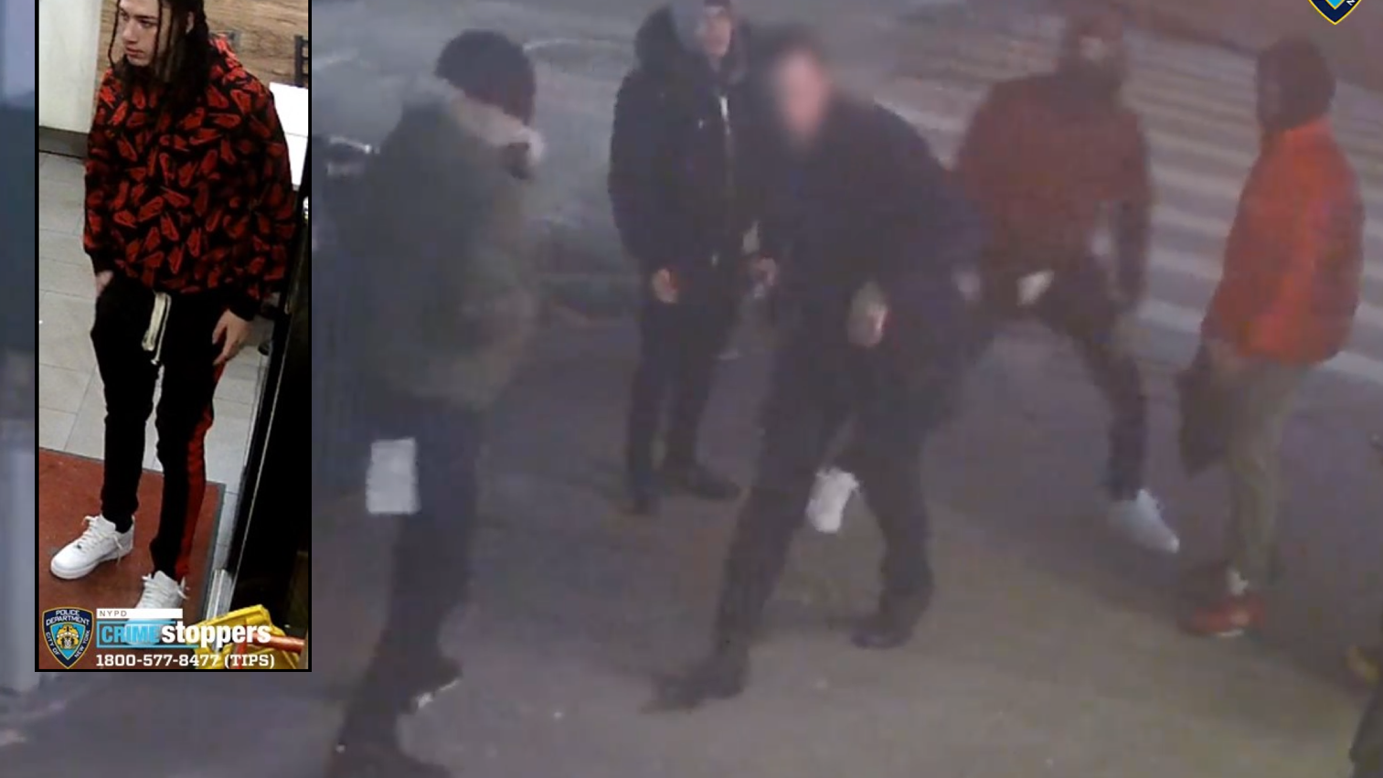VIDEO: Man slashed in face on Midtown street, suspect sought