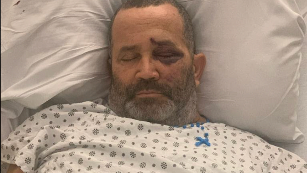 Cab driver assaulted while picking up couple in the Bronx, $3K reward offered for information