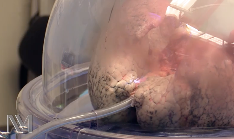 lungs in a box