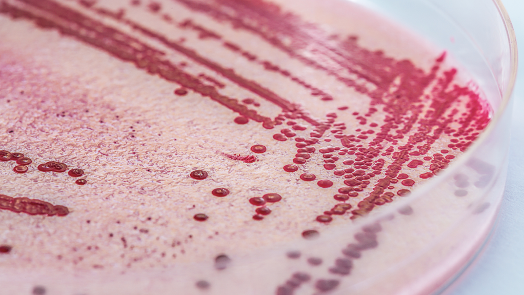 Death of Illinois person tied to listeria outbreak CDC is investigating