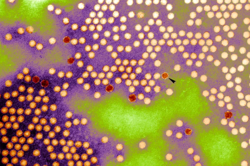 Poliovirus. Transmission Electron Micrograph Of Poliovirus Type 1. Virions Are 20 30 Nm In Diameter And Have Icosahedral Symmetry.