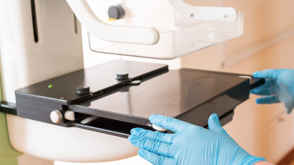 Mammograms more important than ever as pandemic wanes, advocacy group says
