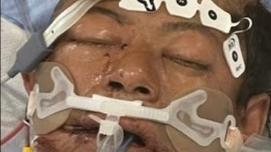 DO YOU KNOW THIS MAN? Authorities attempting to identify cyclist in critical condition after car crash