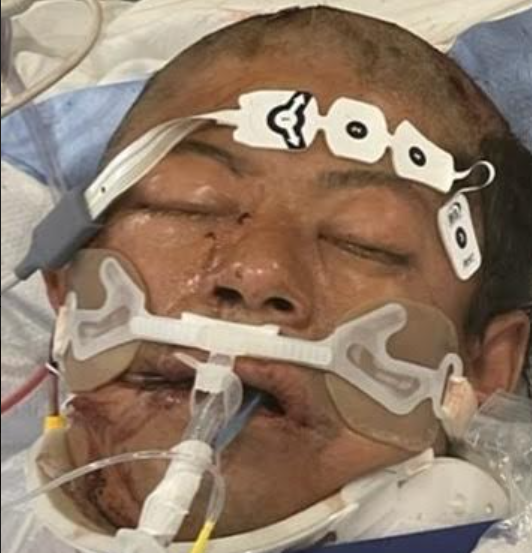 The man police are seeking to identify remains in critical condition at NYU Langone Hospital Brooklyn.