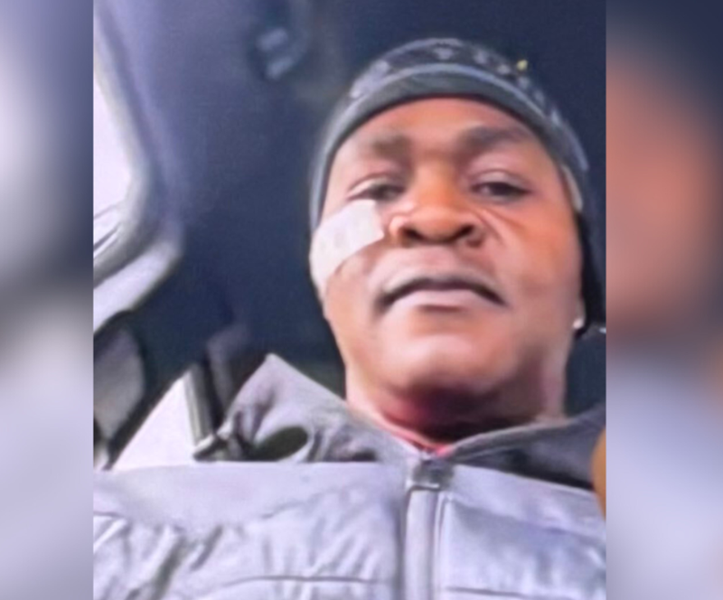 Prince Ezenekwe, a 54-year-old livery cab driver was shot in the cheek by a passenger during a dispute in Brooklyn.